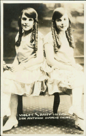 The Hilton Sisters