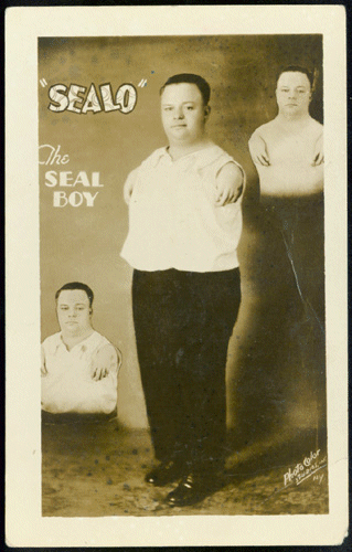 Sealo, The Seal Boy