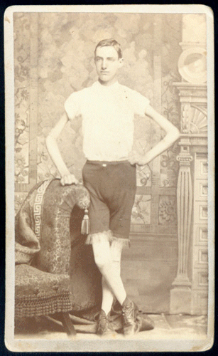 John J. Smith, Living Skeleton